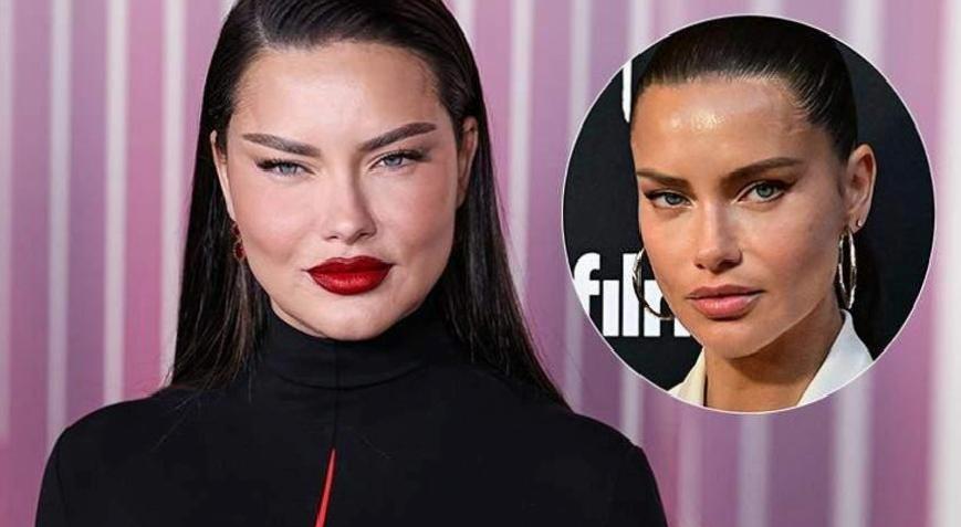 Adriana Lima Estetik İddialarını Yalanladı