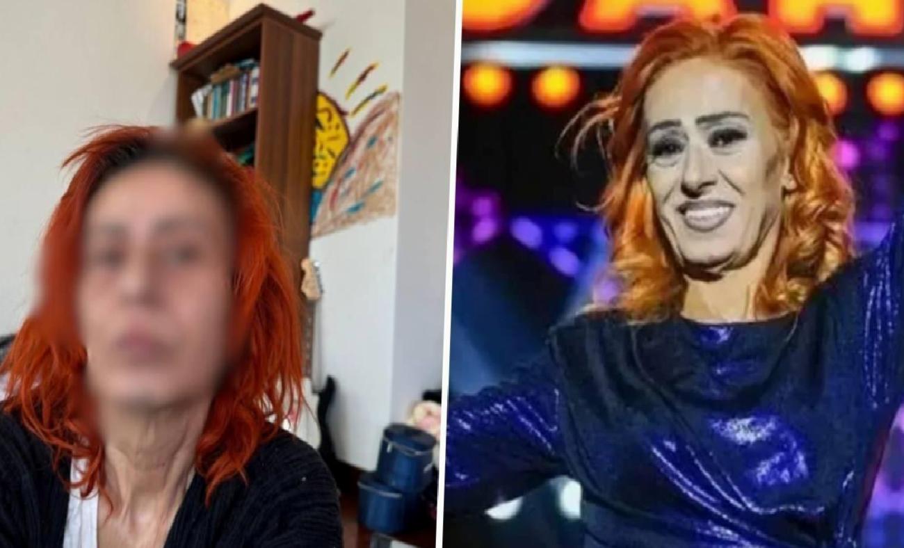 Yıldız Tilbe'nin Talihsiz Saç Boyama Kazası