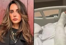 Side-by-side image: a woman with long wavy hair on the left and a hospital bed with a casted arm on the right.